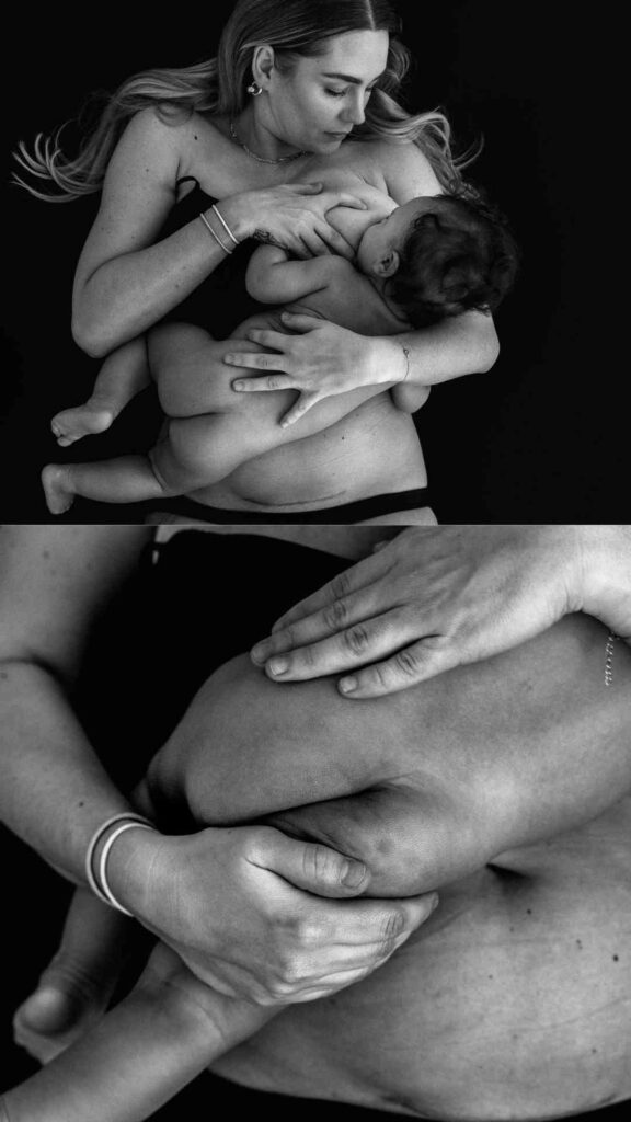 mum breastfeeding her baby. c-section scar is visible